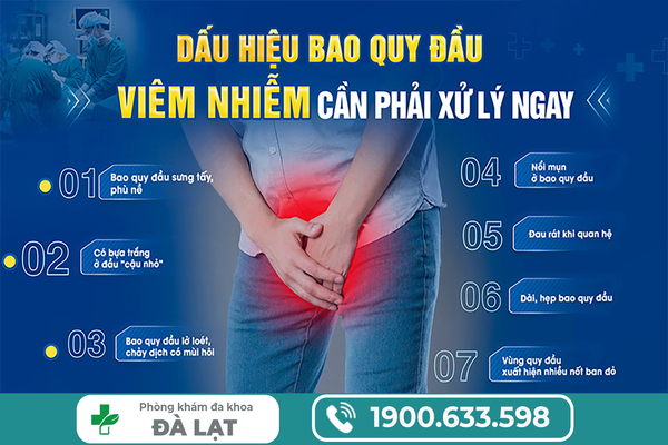 Hình ảnh minh họa